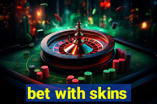 bet with skins