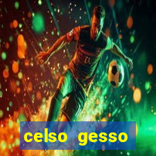 celso gesso cruzeiro sp