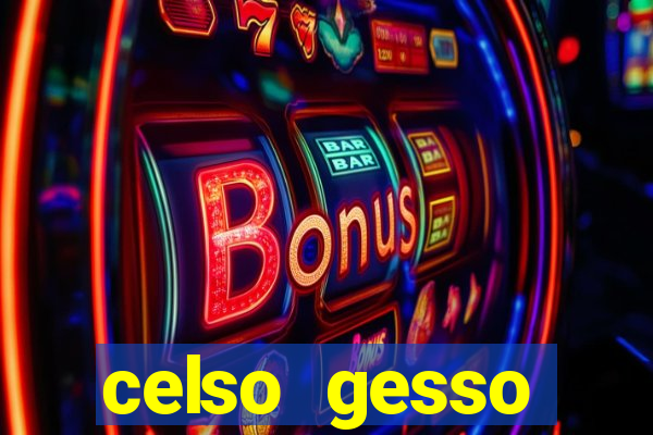 celso gesso cruzeiro sp